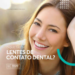 O que são Lentes de contato dental - Edgar Costa Dentista Joinville